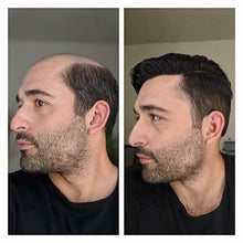 Lade das Bild in den Galerie-Viewer, Gamay Hair Pro-Grade Thin Skin 0.06mm New V-looped Mens Hair Replacement System Transparent Toupee For Men Invisible Hairpiece For Hair Loss - Gamay Hair
