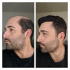 Gamay Hair Pro-Grade Thin Skin 0.06mm New V-looped Mens Hair Replacement System Transparent Toupee For Men Invisible Hairpiece For Hair Loss - Gamay Hair